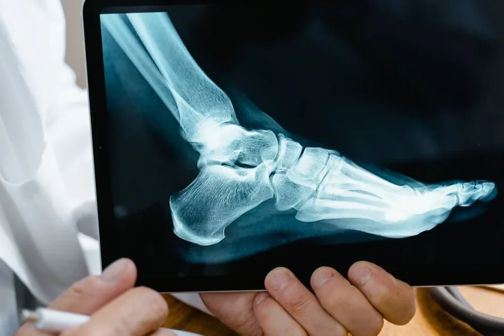 Traumatología y Fracturas