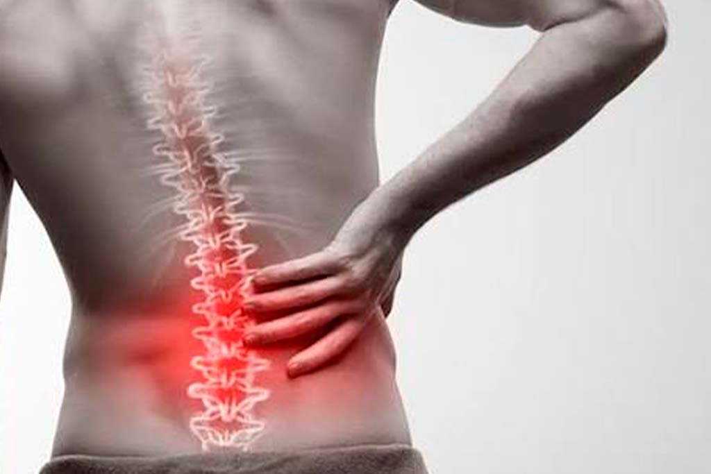 Lumbalgia y Dolor de Columna